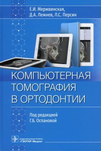 Компьютерная томография в ортодонтии