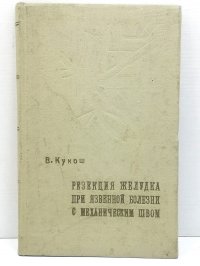 Резекция желудка при язвенной болезни с механическим швом