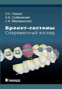 Брекет-системы. Современный взгляд