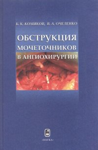 Обструкция мочеточников в ангиохирургии