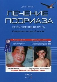 Лечение псориаза. Естественный путь