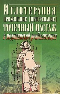 Иглотерапия, прижигание (прогревание), точечный массаж в медицинской реабилитации