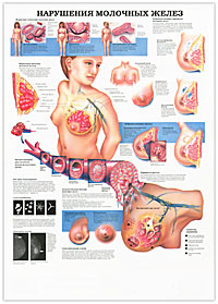 Нарушения молочных желез / Менопауза. Наглядное пособие