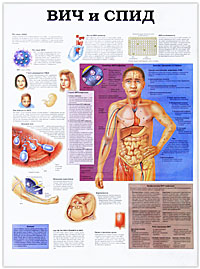 Показания для кесарева сечения / ВИЧ и СПИД. Плакат