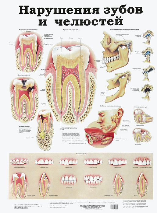 Нарушения зубов и челюстей. Височно-нижнечелюстной сустав. Плакат