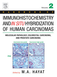 Handbook of Immunohistochemistry and in Situ Hybridization of Human Carcinomas,2