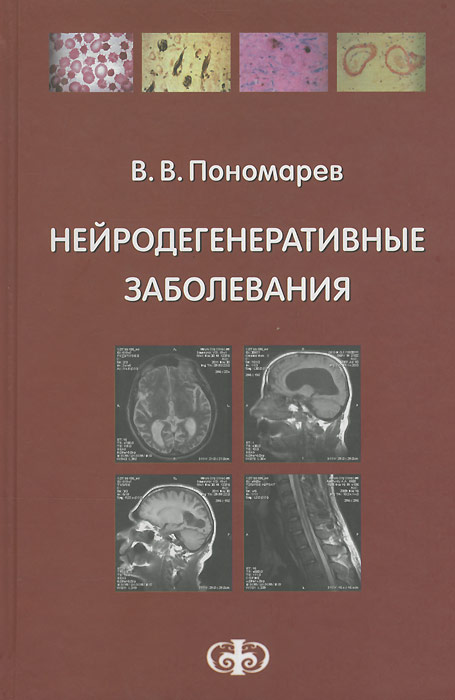 Нейродегенеративные заболевания: Руководство для врачей. Пономарев В.В