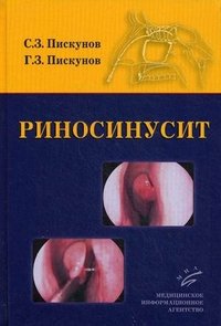 Риносинусит