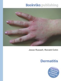 Dermatitis