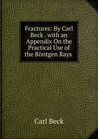 Fractures: By Carl Beck . with an Appendix On the Practical Use of the Rontgen Rays