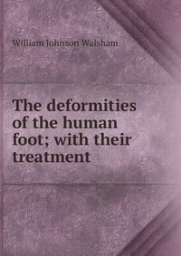 The deformities of the human foot; with their treatment