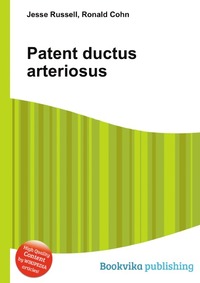 Patent ductus arteriosus